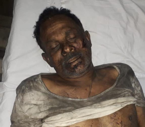 एसईसीएल ढेलवाडीह में खदान में हुआ हादसा एक कर्मचारी की हुई मौत