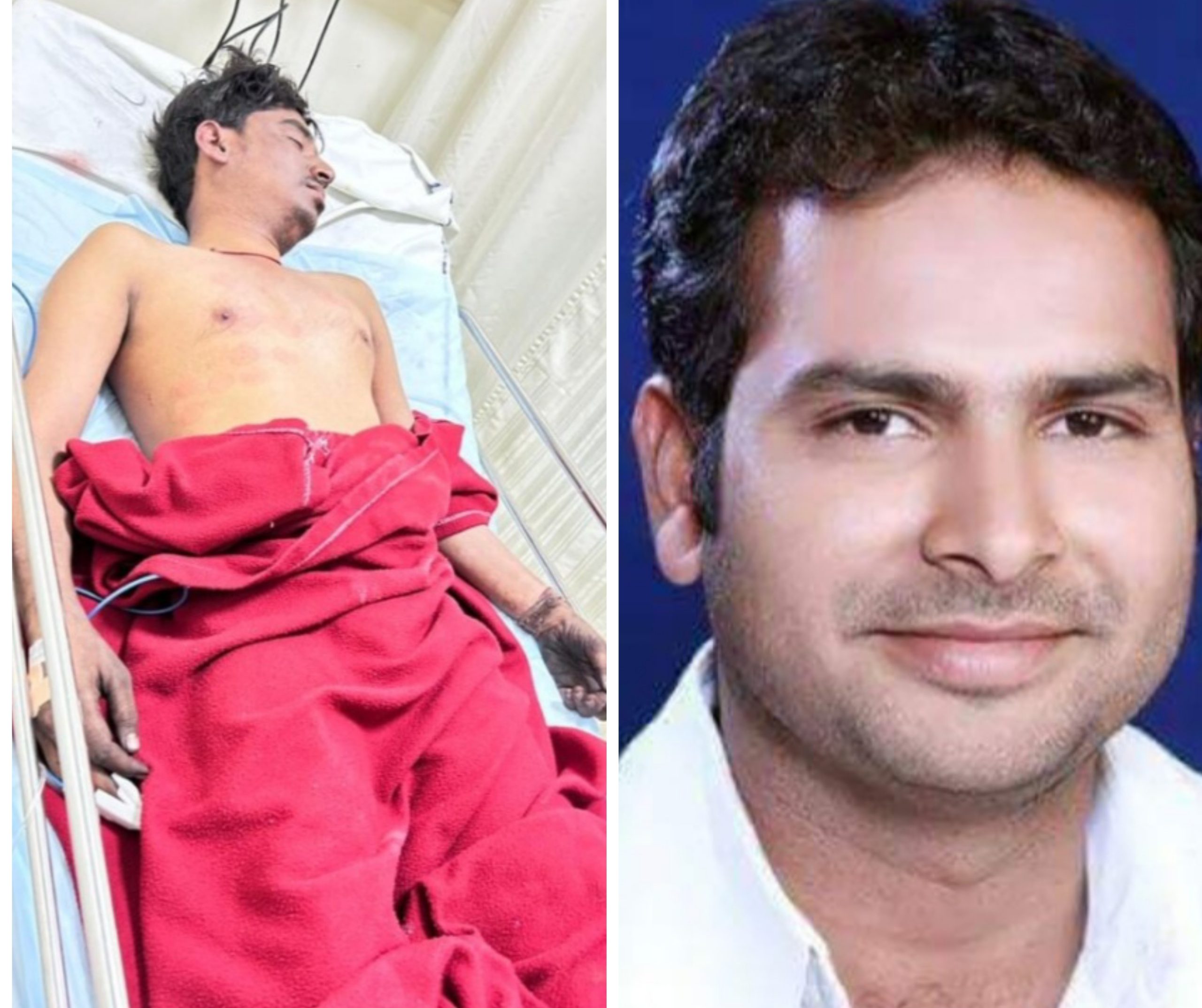 कोयला ट्रांसपोर्टिंग को लेकर नीलकंठ कंपनी के ड्राइवर के साथ मारपीट हालत गंभीर,तीन लोगो पर जुर्म दर्ज