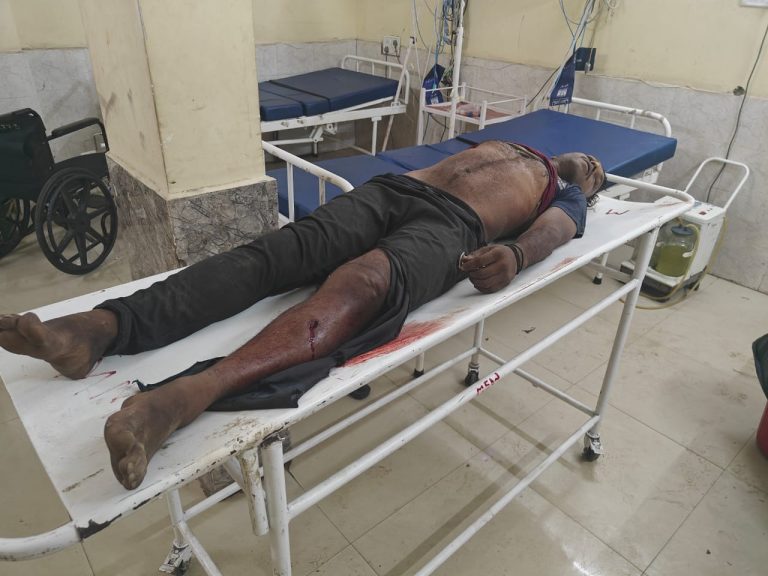 कोरबा:- आदतन बदमाश सूरज हथठेल की मौत,होगी दंडाधिकारी जांच की घोषणा