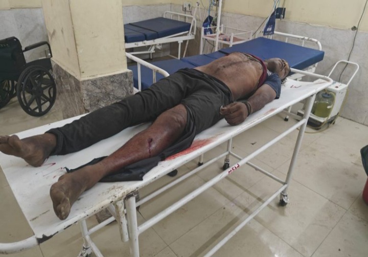 कोरबा:-आदतन बदमाश सूरज हथठेल की मौत,होगी दंडाधिकारी जांच की घोषणा