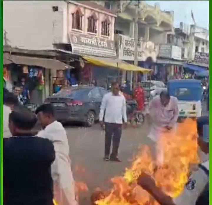 कांग्रेस के पुतला दहन कार्यक्रम में बड़ा हादसा, झुलसे जिला अध्यक्ष, अस्पताल में कराया दाखिल, देखिए वीडियो…