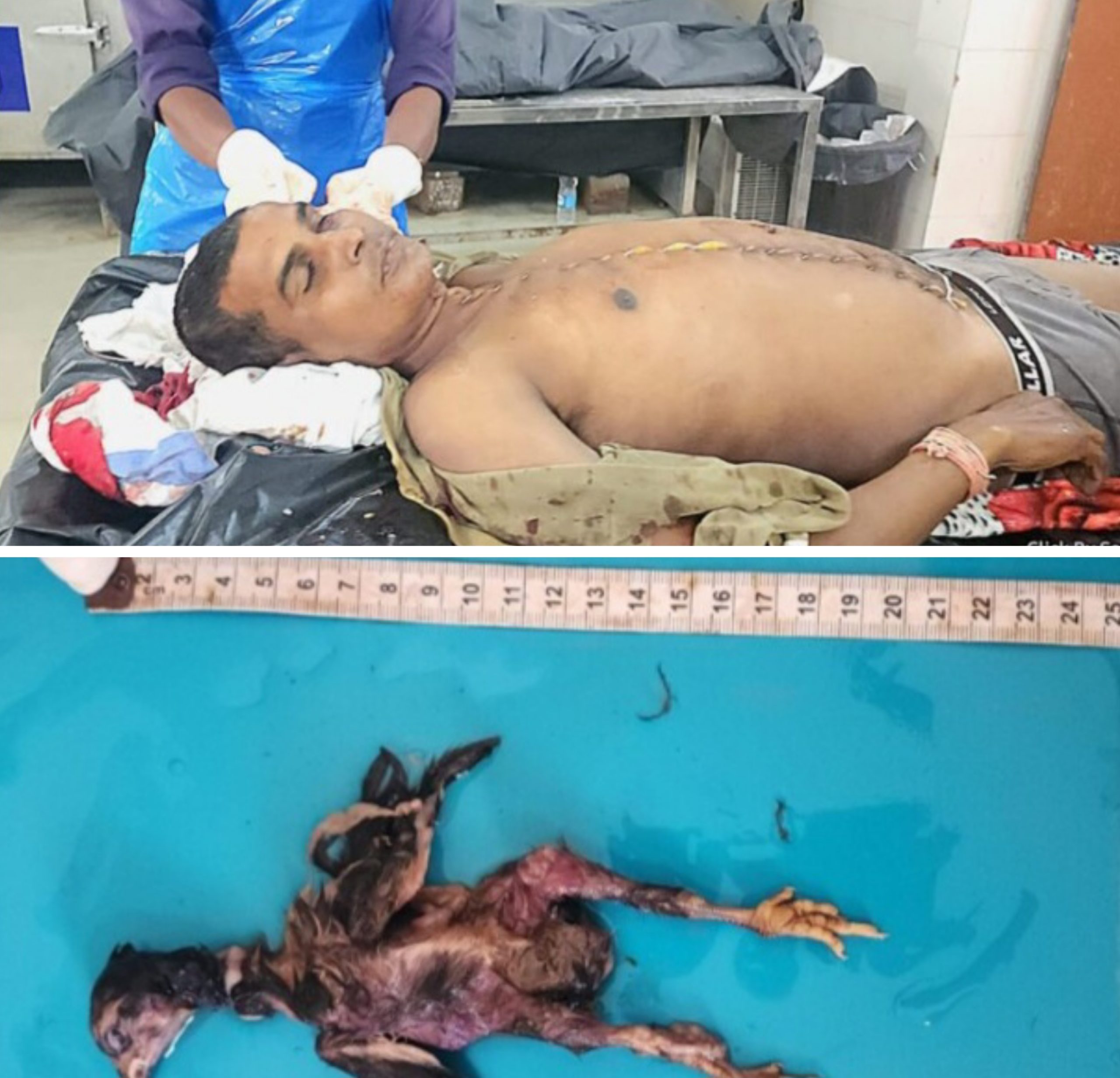 छत्तीसगढ़:- जिंदा मुर्गा निगलने की कोशिश में युवक की मौत, युवक के गले में फंसे मुर्गे को देख डाक्टर भी हैरान..!