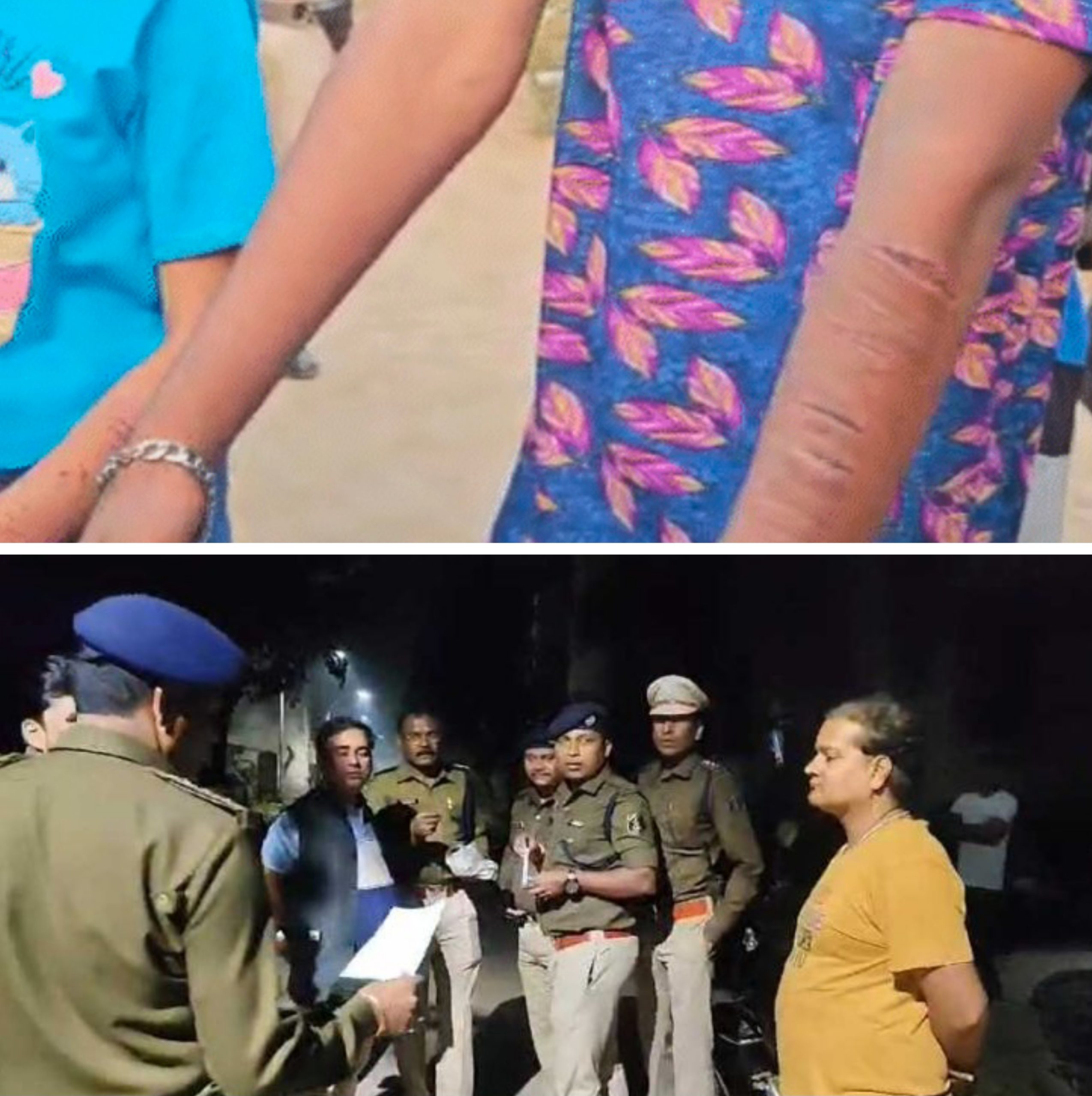 छत्तीसगढ़:- हाथ काटते मिले गर्लफ्रेंड-बॉयफ्रेंड, प्रेमियों के साथ 3 और लड़कियां भी पकड़ाईं, हुक्का-गांजे के साथ 32 लोग हिरासत में