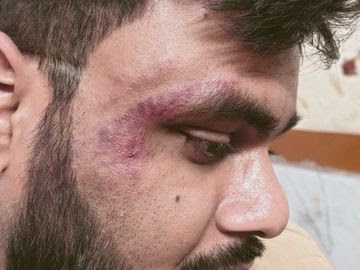 कोरबा: डॉ. अर्पण विश्वास पर जानलेवा हमले की तीखी निंदा करते हुए IMA ने कहा-‘डॉक्टरों की सुरक्षा से कोई समझौता नहीं, दोषियों पर हो कठोर कार्रवाई’