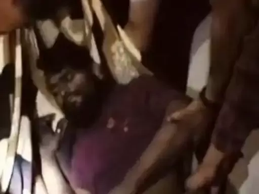 मालगाड़ी की चपेट में आया ट्रक ड्राइवर दाहिना पैर कटा, रेलवे ट्रैक पार करते समय हादसा, इलाज जारी